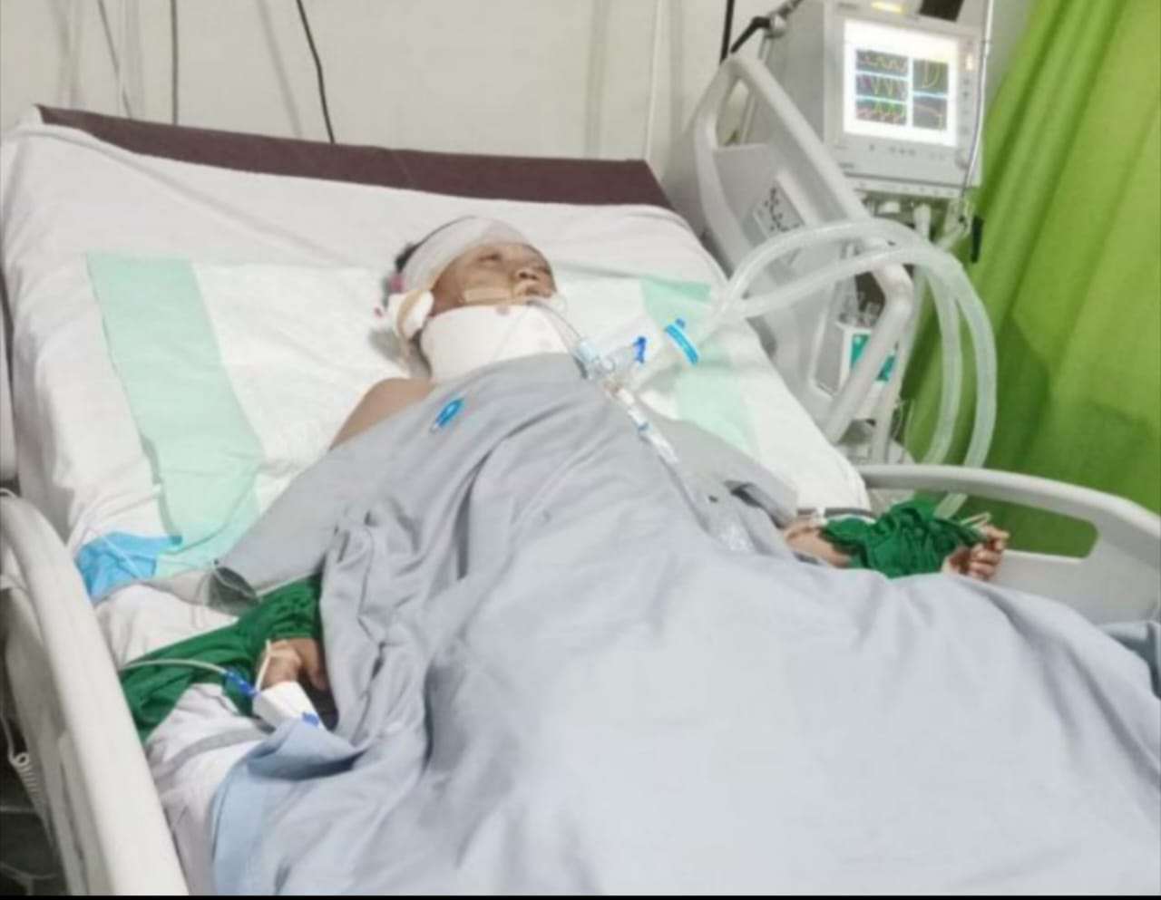 Open Donasi untuk Kairul Nazriel, Siswa SD Karangmulya Korban Kecelakaan Open Donasi untuk Kairul Nazriel, Siswa SD Karangmulya Korban Kecelakaan